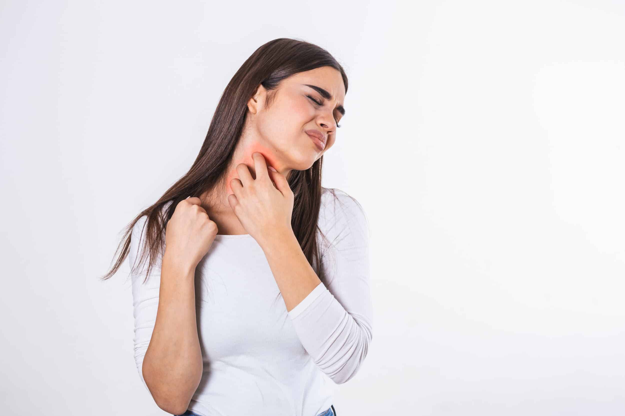 Young woman scratching painful psoriasis on her neck in Plantation, FL.